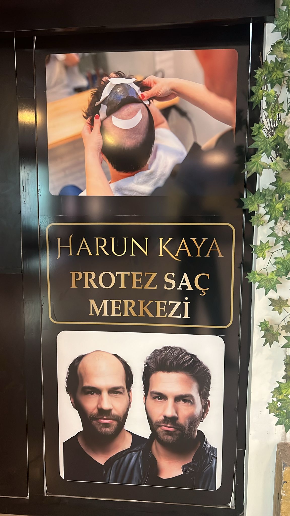 Harun Kaya Beauty center & protez saç merkezi